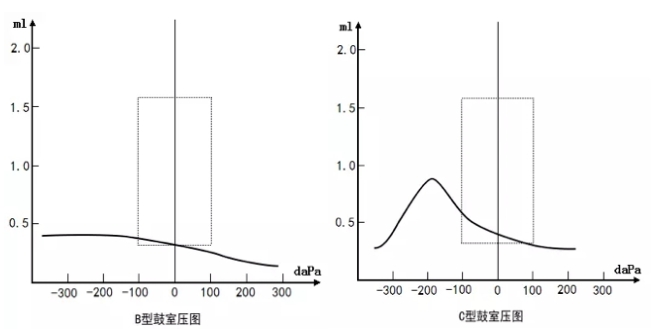 博闻 | 发病率那么高！赶快关注儿童分泌性中耳炎！(图3)