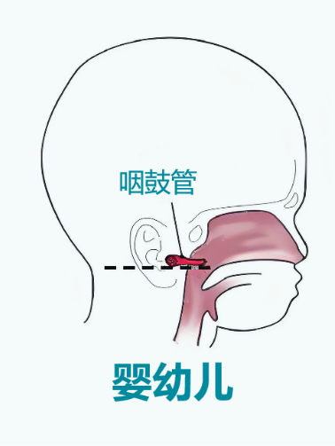 博闻｜咽鼓管功能检查：打开耳部健康的另一扇窗（一）(图3)