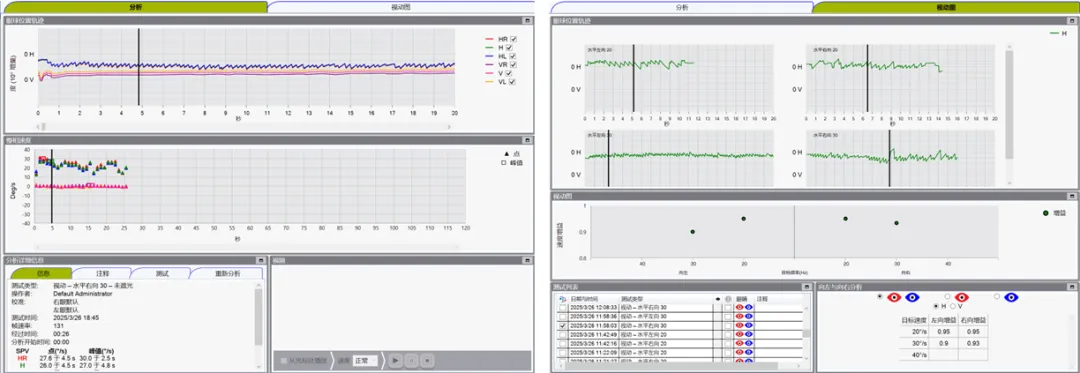 博闻 | VNG眼震视图检查(四)视动试验(图7) 博闻 | VNG眼震视图检查(四)视动试验(图7)